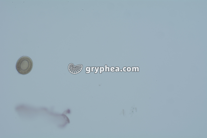 Taenia saginata, oeufs dans déjections x100 - gryphea.org